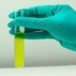 Algae Filters in Ponds and Lakes Benefits and Considerations
